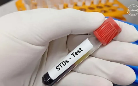 hiv test in dubai