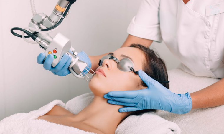 CO2 laser treatment - Midas Aesthetics