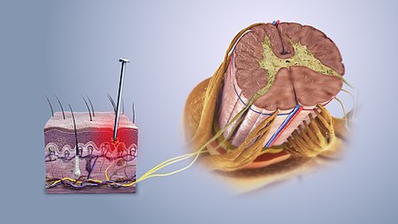 Nociceptive_pain